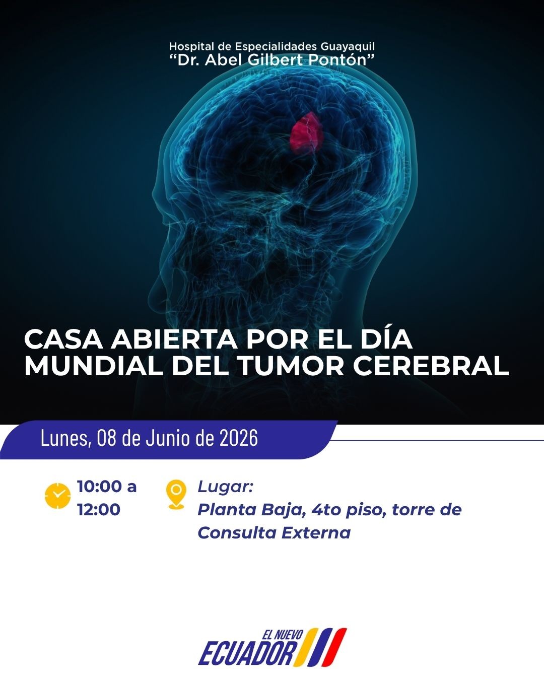 Te invitamos a nuestra Casa Abierta por el Día Mundial del Tumor Cerebral